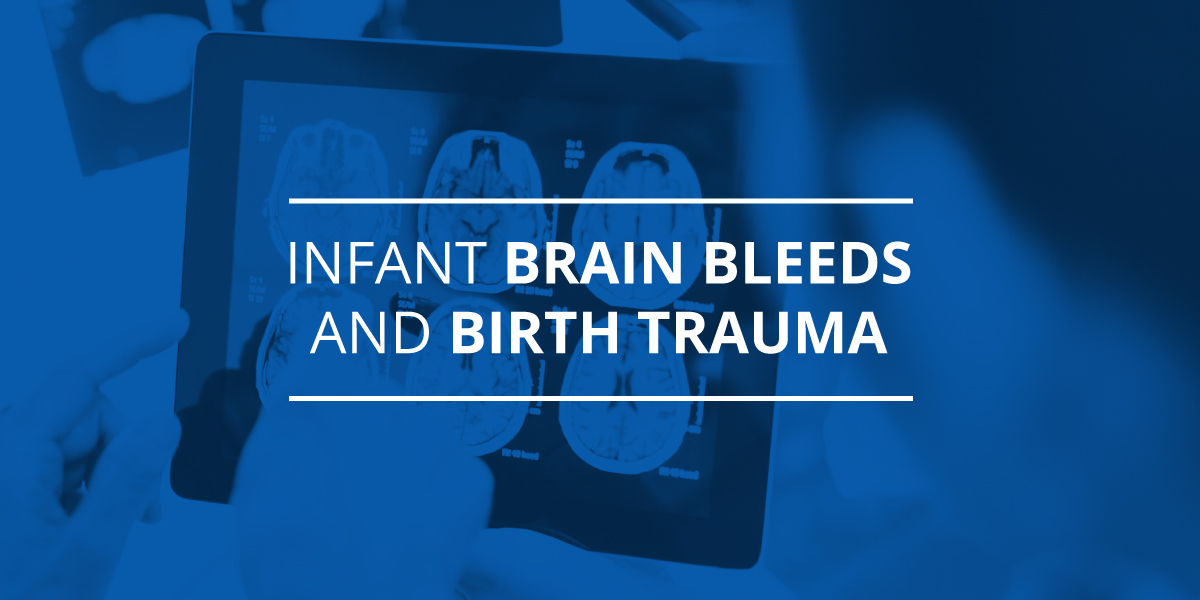 INfant Brain Bleeds and Birth Trauma